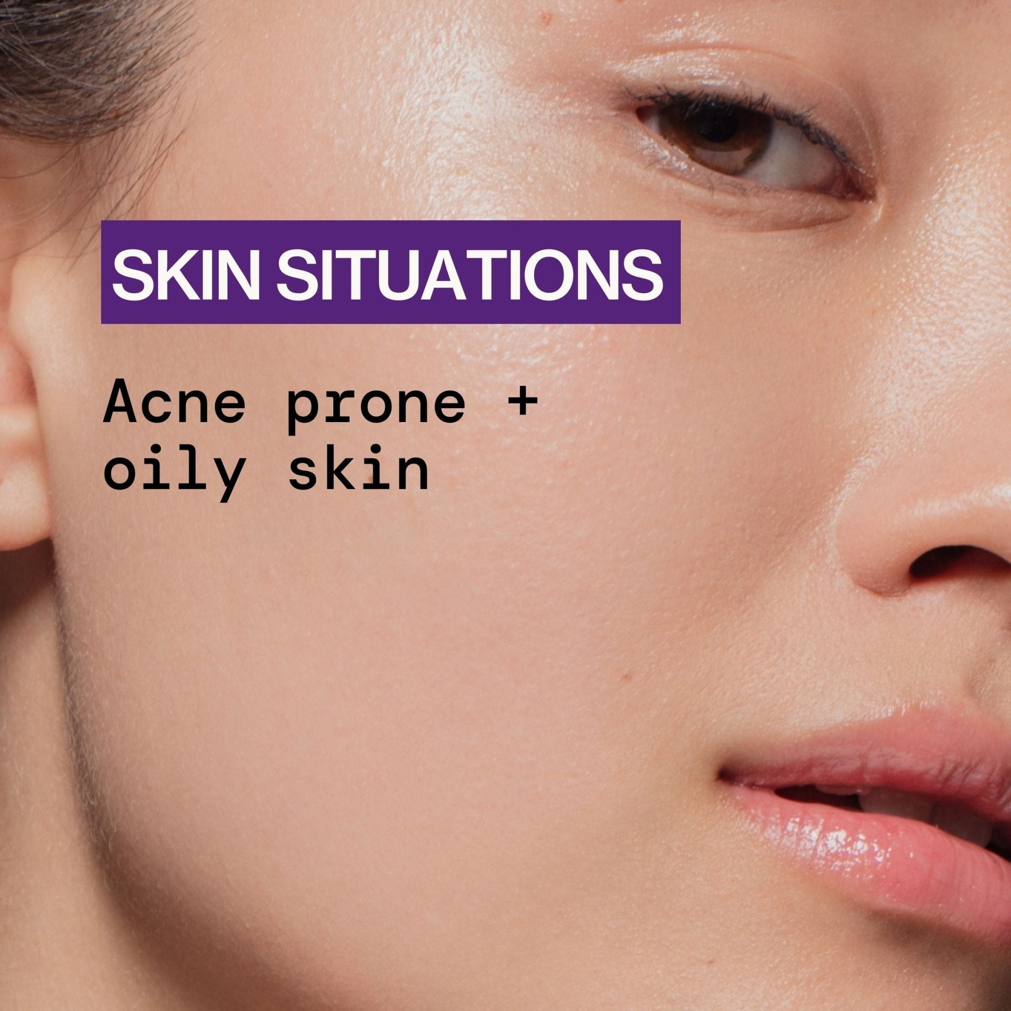 Acne Defense Face Wash - Pacifica